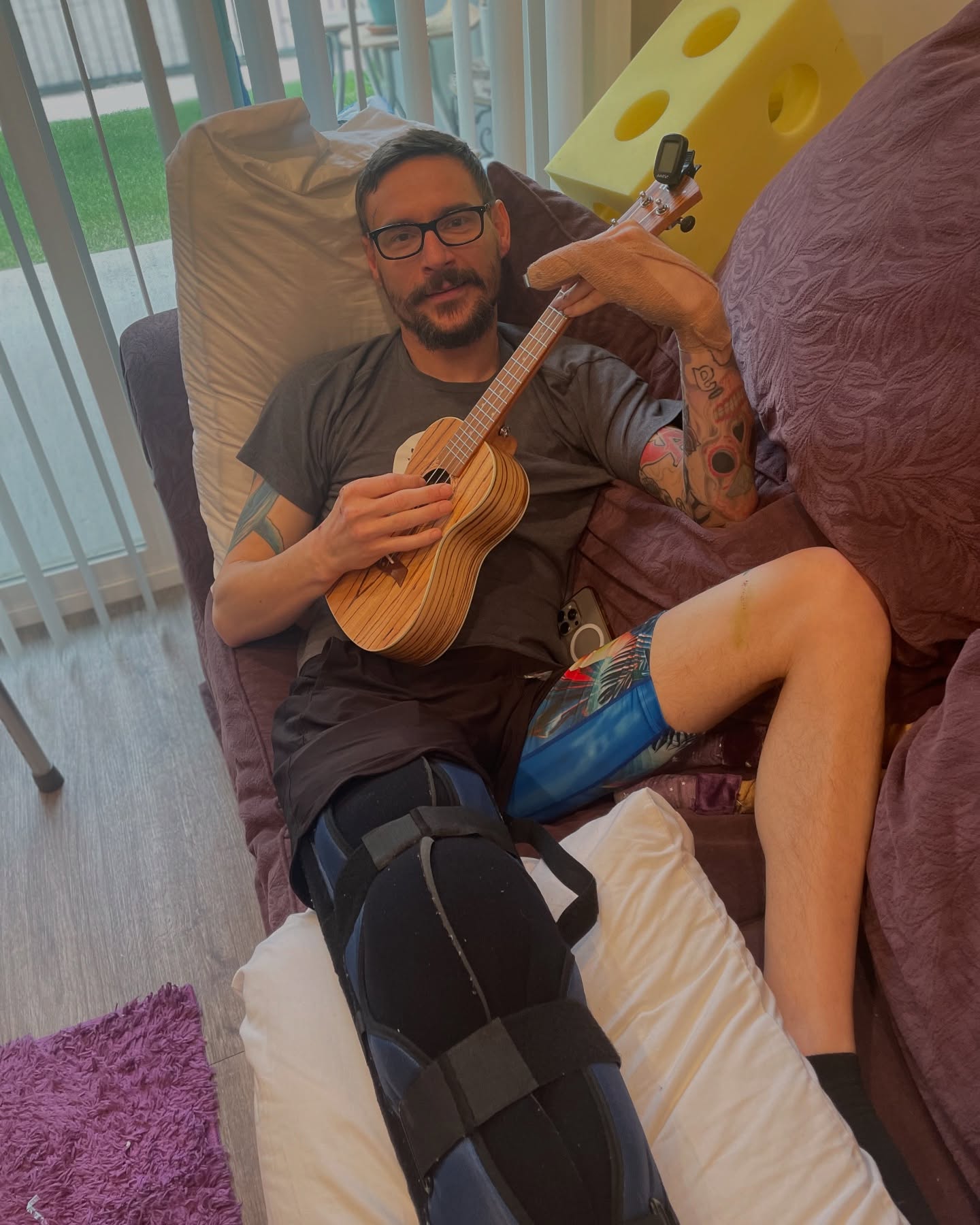 Man with a leg cast holding a ukelele